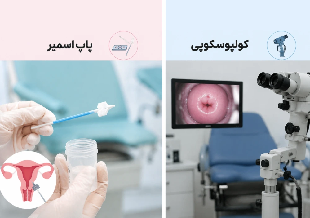 فرق پاپ اسمیر و کولپوسکوپی