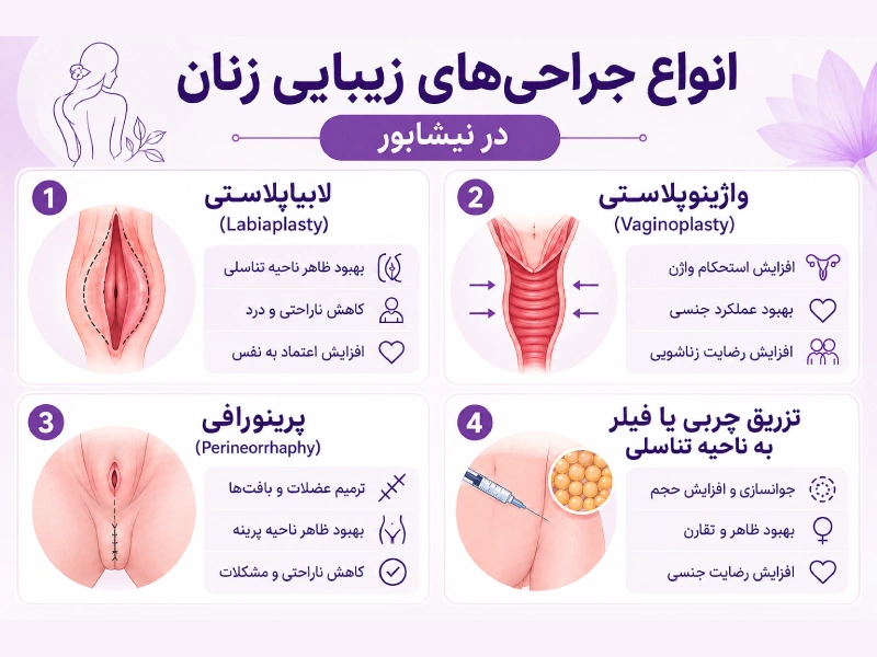 انواع جراحی زیبایی زنان در نیشابور