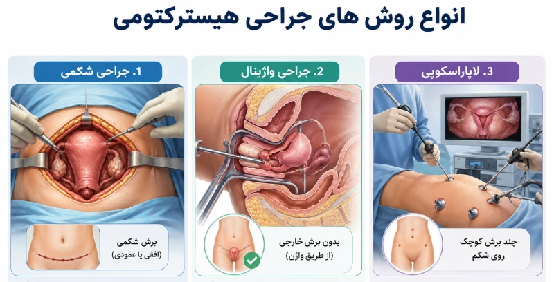 روش های جراحی برداشتن رحم